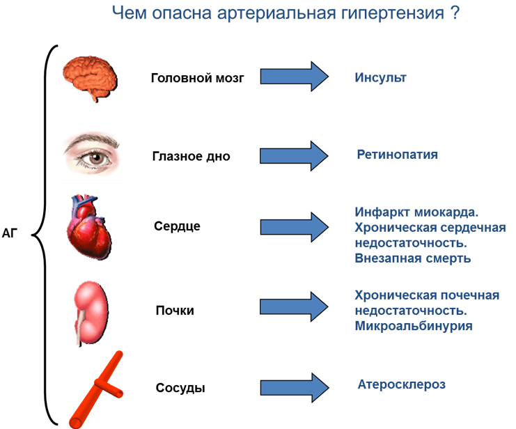 лечение гипертонии в санатории Кирова.png